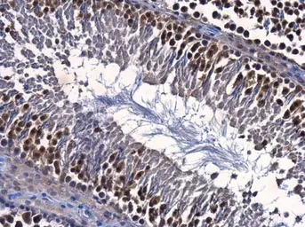 Anti-ENY2 antibody [GT245] used in IHC (Paraffin sections) (IHC-P). GTX629542