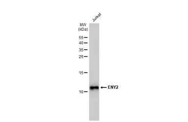 Anti-ENY2 antibody [GT245] used in Western Blot (WB). GTX629542
