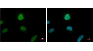 Anti-ENY2 antibody [GT245] used in Immunocytochemistry/ Immunofluorescence (ICC/IF). GTX629542
