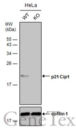Anti-p21 Cip1 antibody [GT8611] used in Western Blot (WB). GTX629627