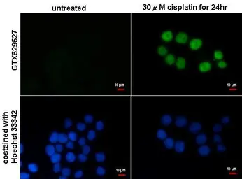 Anti-p21 Cip1 antibody [GT8611] used in Immunocytochemistry/ Immunofluorescence (ICC/IF). GTX629627