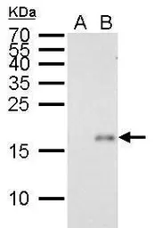 Anti-p21 Cip1 antibody [GT8611] used in Western Blot (WB). GTX629627
