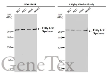 Anti-Fatty Acid Synthase antibody [GT237] used in Western Blot (WB). GTX629628