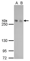 Anti-Fatty Acid Synthase antibody [GT237] used in Western Blot (WB). GTX629628