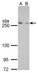 Anti-Fatty Acid Synthase antibody [GT237] used in Western Blot (WB). GTX629628