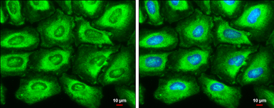 Anti-Fatty Acid Synthase antibody [GT325] used in Immunocytochemistry/ Immunofluorescence (ICC/IF). GTX629629