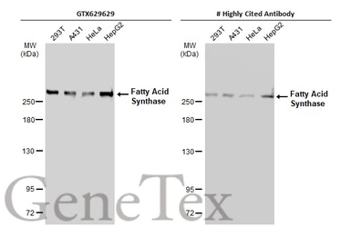 Anti-Fatty Acid Synthase antibody [GT325] used in Western Blot (WB). GTX629629