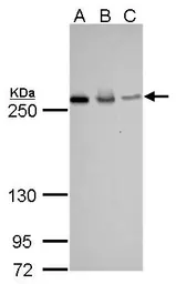 Anti-Fatty Acid Synthase antibody [GT325] used in Western Blot (WB). GTX629629