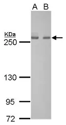 Anti-Fatty Acid Synthase antibody [GT325] used in Western Blot (WB). GTX629629