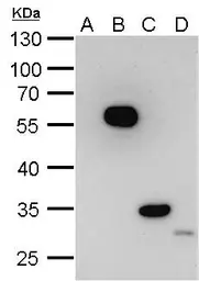 Anti-DDDDK tag antibody [GT1423] used in Western Blot (WB). GTX629632