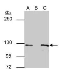 Anti-E-Cadherin antibody [GT311] used in Immunoprecipitation (IP). GTX629692