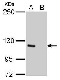 Anti-E-Cadherin antibody [GT311] used in Western Blot (WB). GTX629692