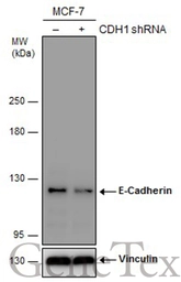 Anti-E-Cadherin antibody [GT358] used in Western Blot (WB). GTX629694
