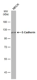 Anti-E-Cadherin antibody [GT358] used in Western Blot (WB). GTX629694