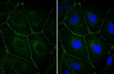 Anti-E-Cadherin antibody [GT358] used in Immunocytochemistry/ Immunofluorescence (ICC/IF). GTX629694