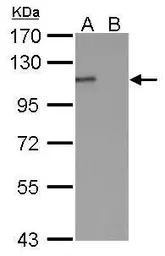 Anti-E-Cadherin antibody [GT358] used in Western Blot (WB). GTX629694