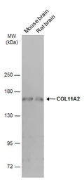 Anti-COL11A2 antibody [GT6410] used in Western Blot (WB). GTX629739