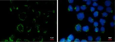Anti-COL11A2 antibody [GT473] used in Immunocytochemistry/ Immunofluorescence (ICC/IF). GTX629740