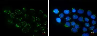 Anti-COL11A2 antibody [GT473] used in Immunocytochemistry/ Immunofluorescence (ICC/IF). GTX629740
