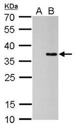 Anti-COL11A2 antibody [GT473] used in Western Blot (WB). GTX629740