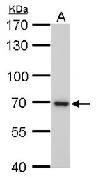 Anti-UVSSA antibody [GT816] used in Western Blot (WB). GTX629742