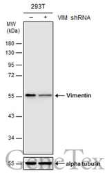Anti-Vimentin antibody [GT7812] used in Western Blot (WB). GTX629743