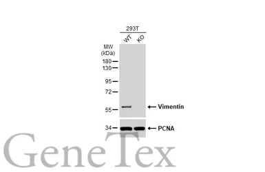 Anti-Vimentin antibody [GT7812] used in Western Blot (WB). GTX629743