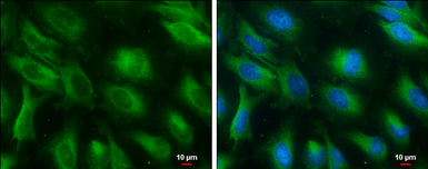 Anti-PGAM1 antibody [GT256] used in Immunocytochemistry/ Immunofluorescence (ICC/IF). GTX629745