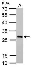 Anti-PGAM1 antibody [GT256] used in Western Blot (WB). GTX629745