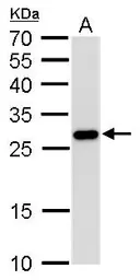 Anti-PGAM1 antibody [GT256] used in Western Blot (WB). GTX629745