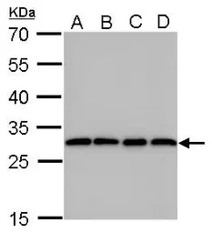 Anti-PGAM1 antibody [GT256] used in Western Blot (WB). GTX629745
