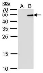 Anti-IL28B antibody [GT2512] used in Western Blot (WB). GTX629760