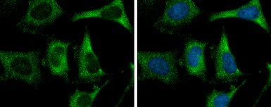 Anti-Fatty Acid Synthase antibody [GT5210] used in Immunocytochemistry/ Immunofluorescence (ICC/IF). GTX629761