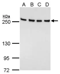 Anti-Fatty Acid Synthase antibody [GT5210] used in Western Blot (WB). GTX629761
