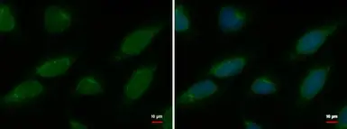 Anti-Nucleoporin p62 antibody [GT252] used in Immunocytochemistry/ Immunofluorescence (ICC/IF). GTX629763