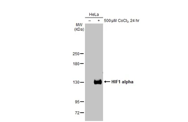 Anti-HIF1 alpha antibody [GT122] used in Western Blot (WB). GTX629766