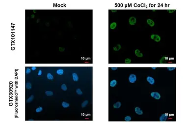 Anti-HIF1 alpha antibody [GT122] used in Immunocytochemistry/ Immunofluorescence (ICC/IF). GTX629766