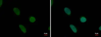 Anti-PRDM14 antibody [GT1359] used in Immunocytochemistry/ Immunofluorescence (ICC/IF). GTX629805