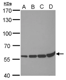 Anti-PRDM14 antibody [GT1359] used in Western Blot (WB). GTX629805