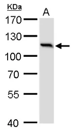 Anti-O-GlcNAc transferase antibody [GT2037] used in Western Blot (WB). GTX629813
