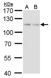 Anti-O-GlcNAc transferase antibody [GT2037] used in Western Blot (WB). GTX629813