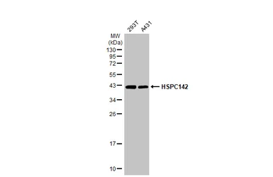 Anti-HSPC142 antibody [GT1251] used in Western Blot (WB). GTX629814