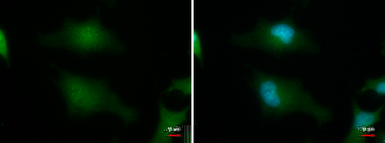 Anti-HSPC142 antibody [GT1251] used in Immunocytochemistry/ Immunofluorescence (ICC/IF). GTX629814