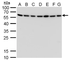Anti-ATG12 antibody [GT166] used in Western Blot (WB). GTX629815
