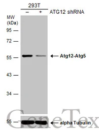 Anti-ATG12 antibody [GT948] used in Western Blot (WB). GTX629816
