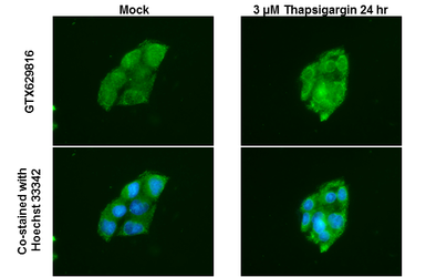 Anti-ATG12 antibody [GT948] used in Immunocytochemistry/ Immunofluorescence (ICC/IF). GTX629816