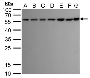 Anti-ATG12 antibody [GT948] used in Western Blot (WB). GTX629816