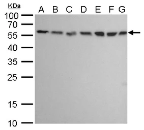 Anti-ATG12 antibody [GT9411] used in Western Blot (WB). GTX629817