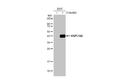 Anti-HSPC142 antibody [GT2810] used in Western Blot (WB). GTX629878