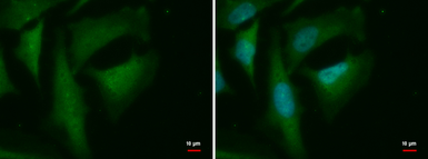Anti-HSPC142 antibody [GT2810] used in Immunocytochemistry/ Immunofluorescence (ICC/IF). GTX629878